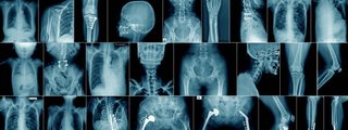 Pociciones radiograficas