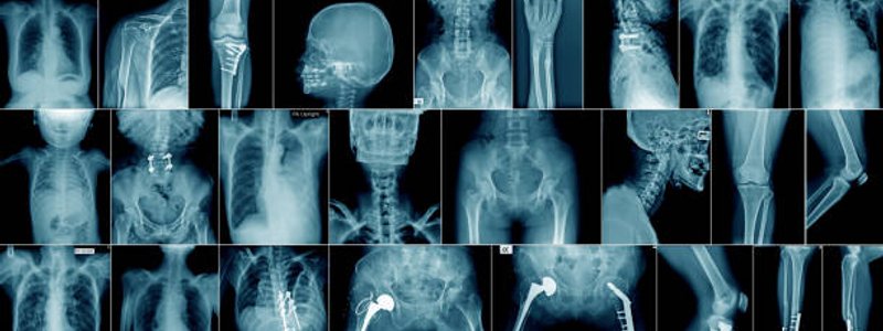 Pociciones radiograficas