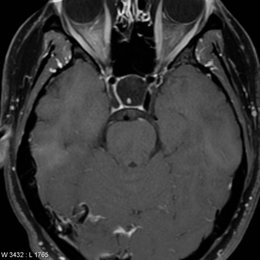 &iquest;Cu&aacute;l es el diagn&oacute;stico m&aacute;s probable de la siguiente imagen? - Espa&ntilde;ol