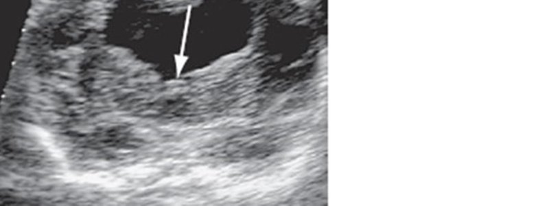 alem&aacute;n practico