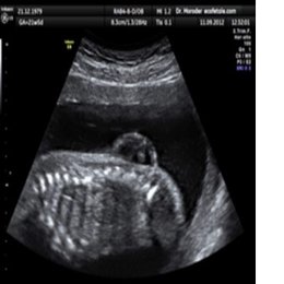 MARQUE LA RESPUESTA CORRECTA  - alem&aacute;n practico