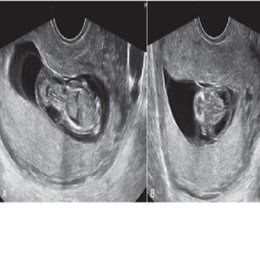 MARQUE LA RESPUESTA CORRECTA  - alem&aacute;n practico