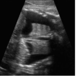 MARQUE LA RESPUESTA CORRECTA  - alem&aacute;n practico