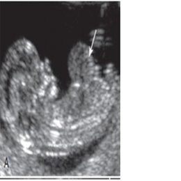 MARQUE LA RESPUESTA CORRECTA  - alem&aacute;n practico