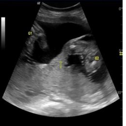 MARQUE LA RESPUESTA CORRECTA  - alem&aacute;n practico