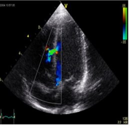MARQUE LA RESPUESTA CORRECTA  - alem&aacute;n practico