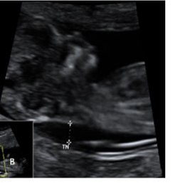 MARQUE LA RESPUESTA CORRECTA  - alem&aacute;n practico