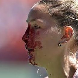 PARA EVITAR UN GOLPE QUE SE RECOMIENDA? - CUANTO SABES DE HOCKEY