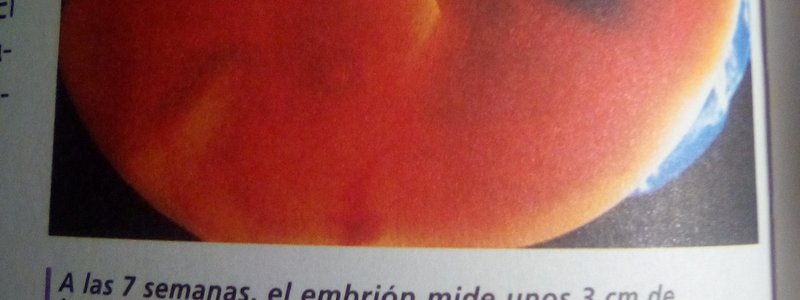 Que dinosaurio eres?
