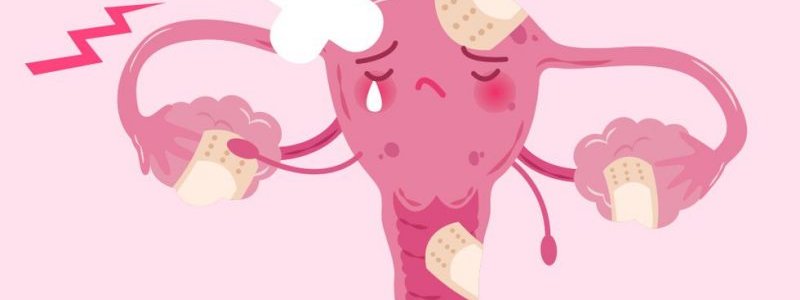 Infecciones Vulvovaginales