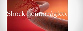 Shock Hemorrágico