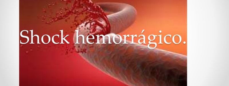 Shock Hemorrágico